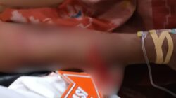 Lagi! Warga Sipil Jadi Korban penganiayaan dengan menggunakan senjata tajam di Yahukimo, Diduga Dilakukan KKB